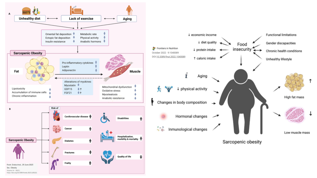obesidade sarcopênica e as canaetas emagrecedoras